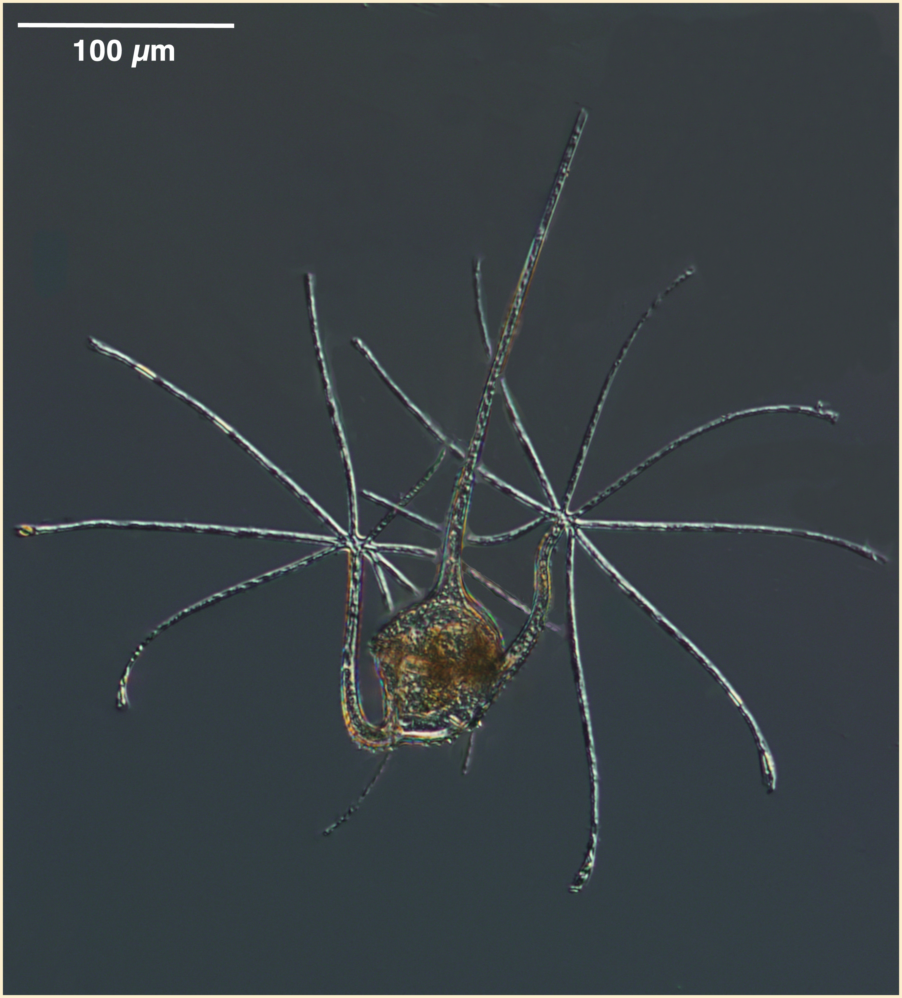 Ceratium ranipes - a specimen with especially long fingers