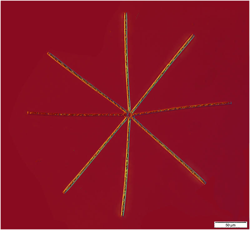Stick Star Diatom