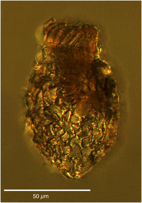 Tintinnopsis beroidea