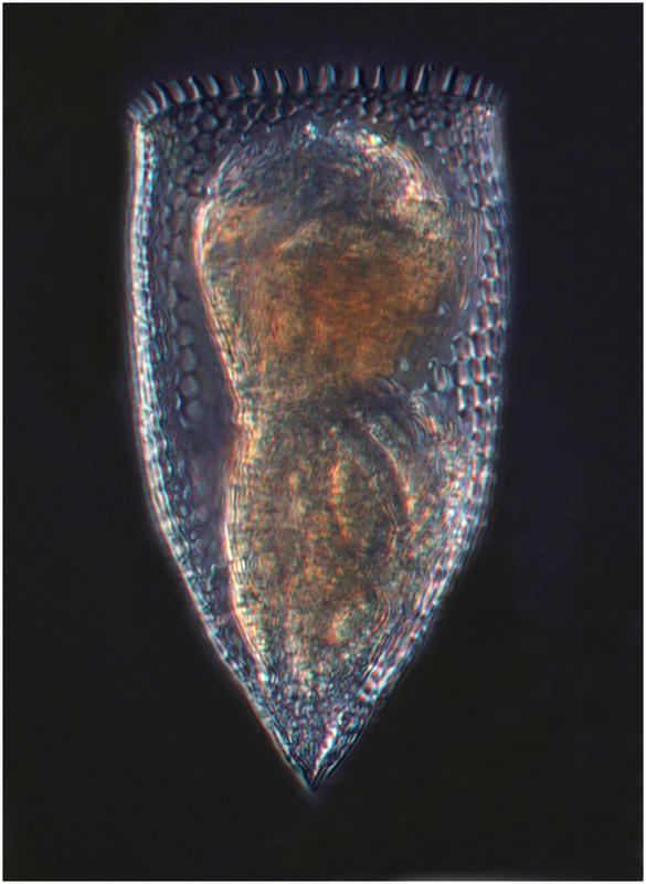 Parafavella in cell division