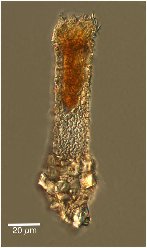 Codonellopsis lusitanica