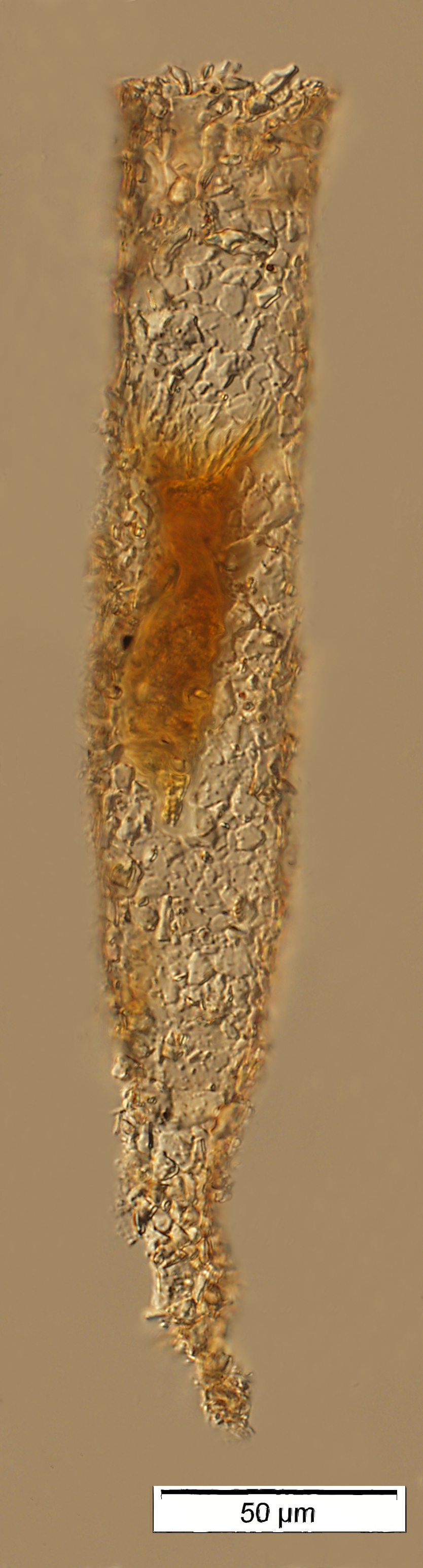 Tintinnopsis radix