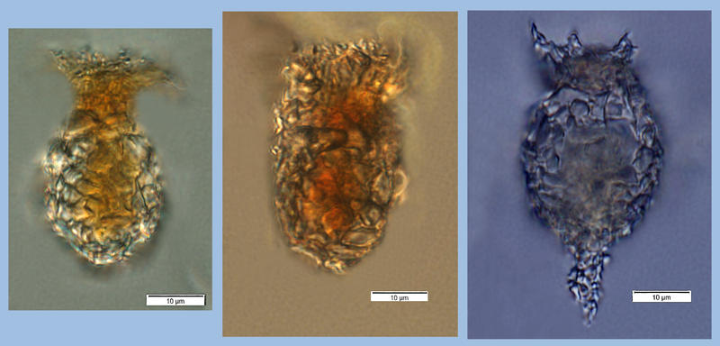 Tintinnopsis minuta-like forms