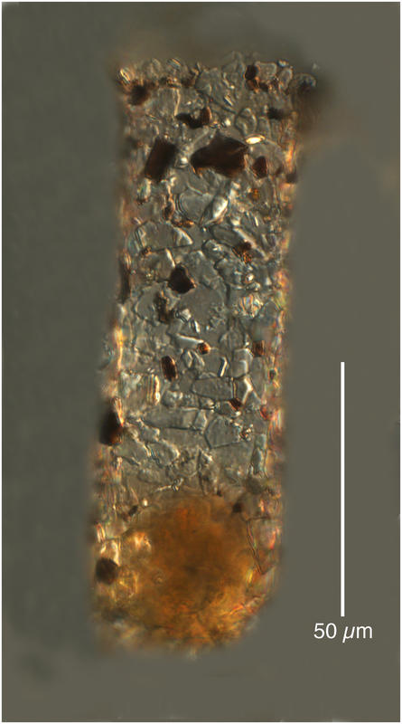 Tintinnopsis rotundata