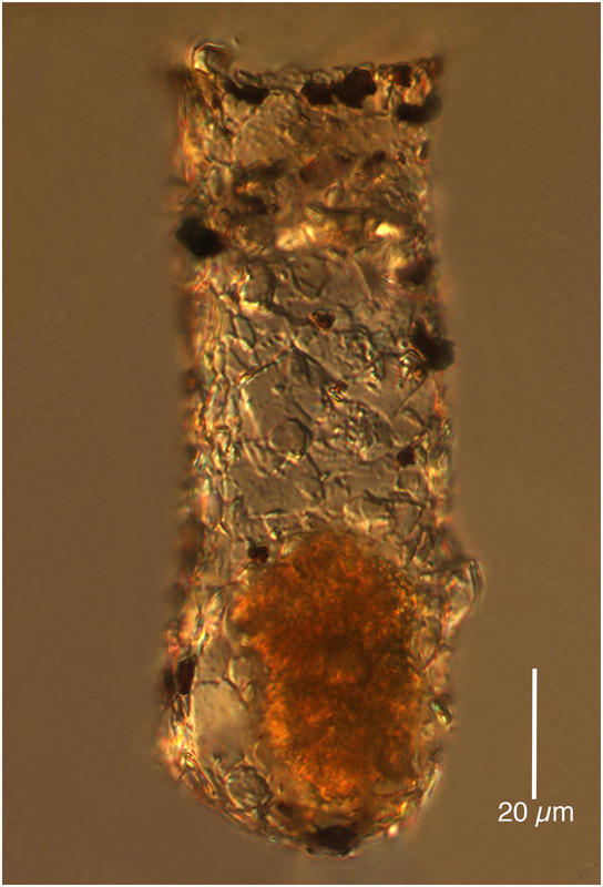 Tintinnopsis rotundata