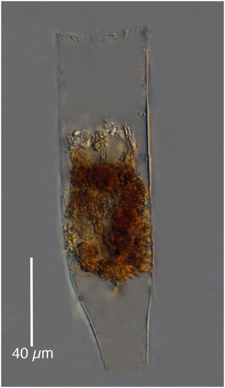 Eutintinnus apertus (Kofoid & Campbel 1929)