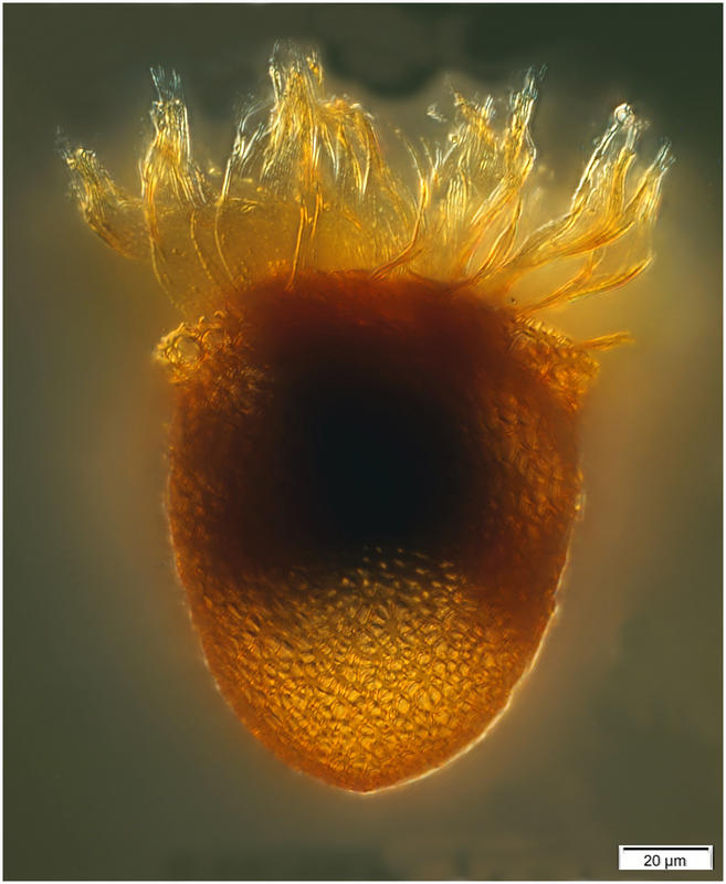 Cyttarocylis eucecryphalus morph