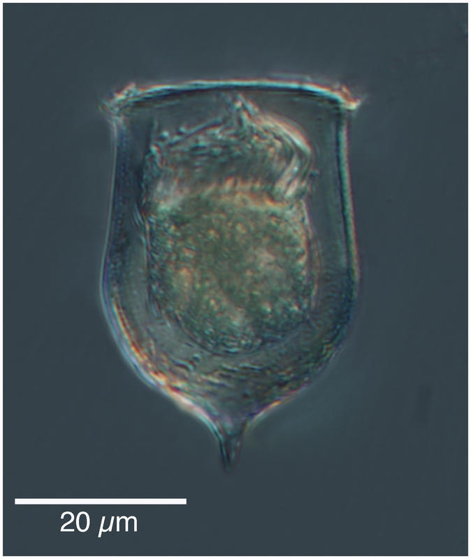 Acanthostomella norvegica