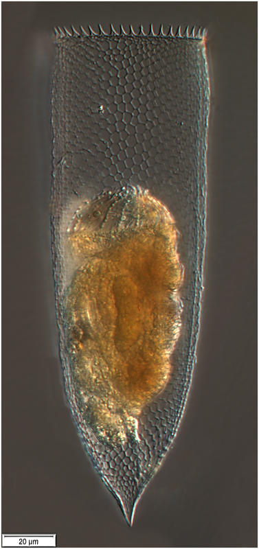 Parafavella subrotundata