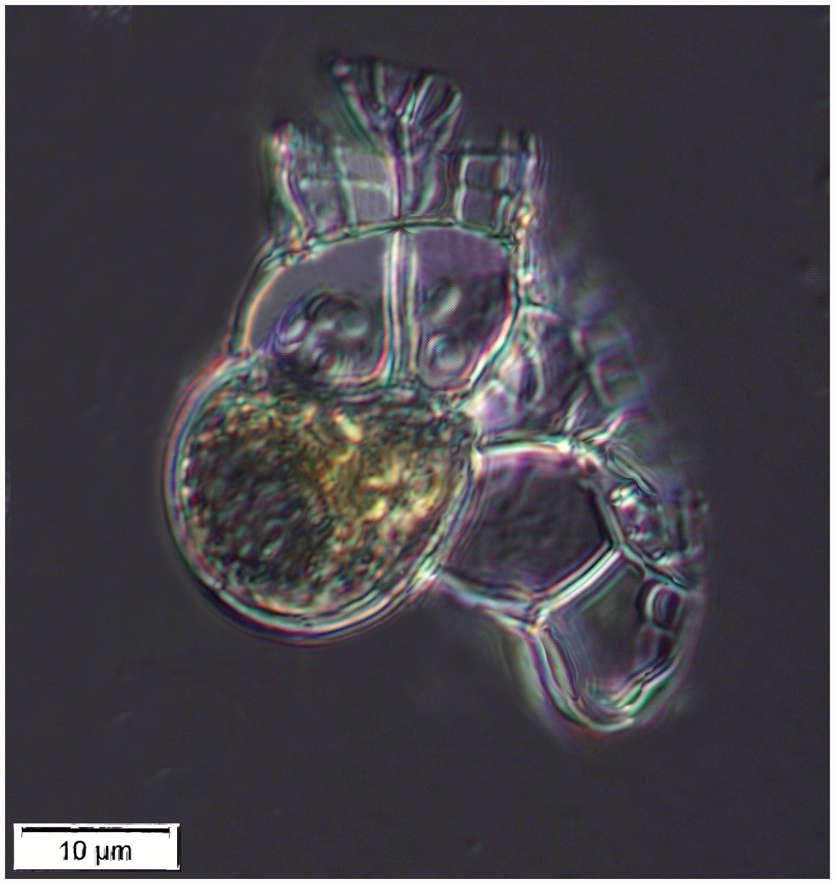 Histioneis sp.