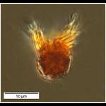 A tiny oligotrich ciliate