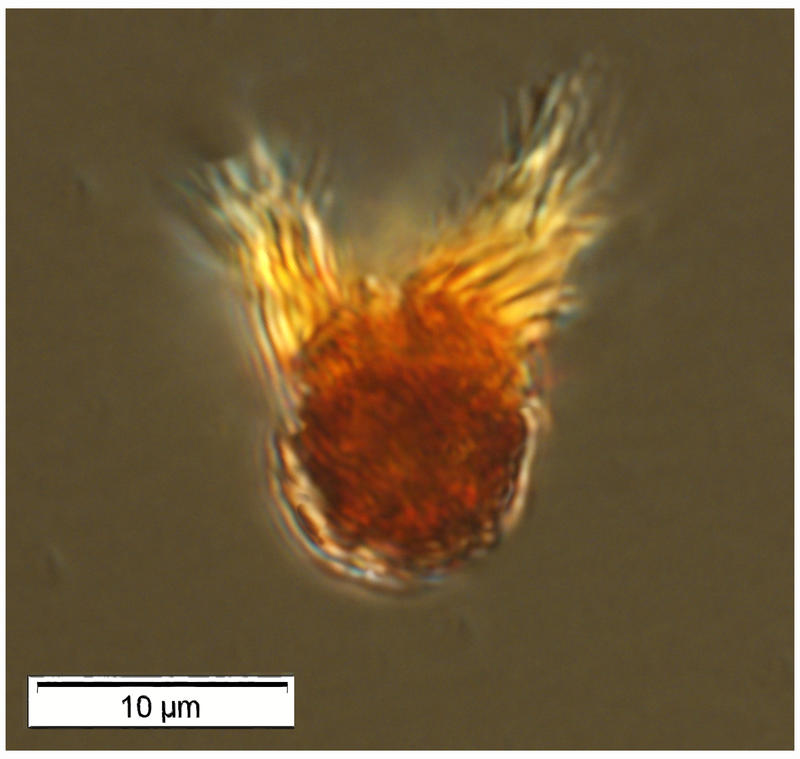 A tiny oligotrich ciliate