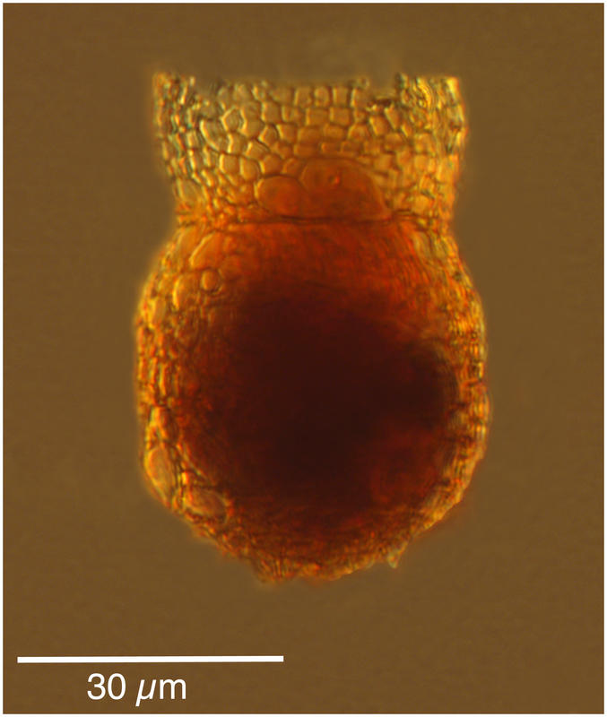 Codonella apicata (Kofoid & Campbell 1929)