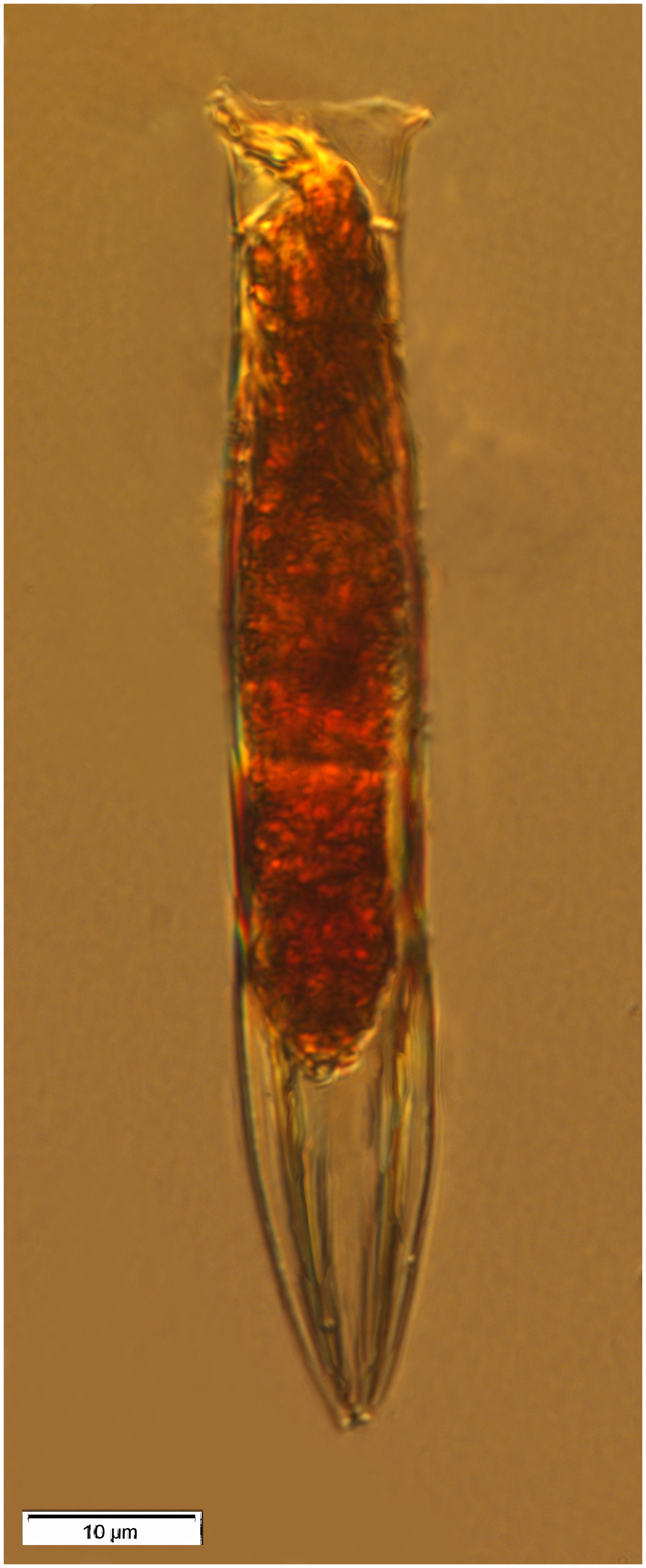 Salpingella rotundata (Kofoid & Campbell 1929)