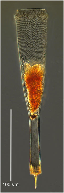 Xystonellopsis cyclas (Kofoid & Campbell 1929)