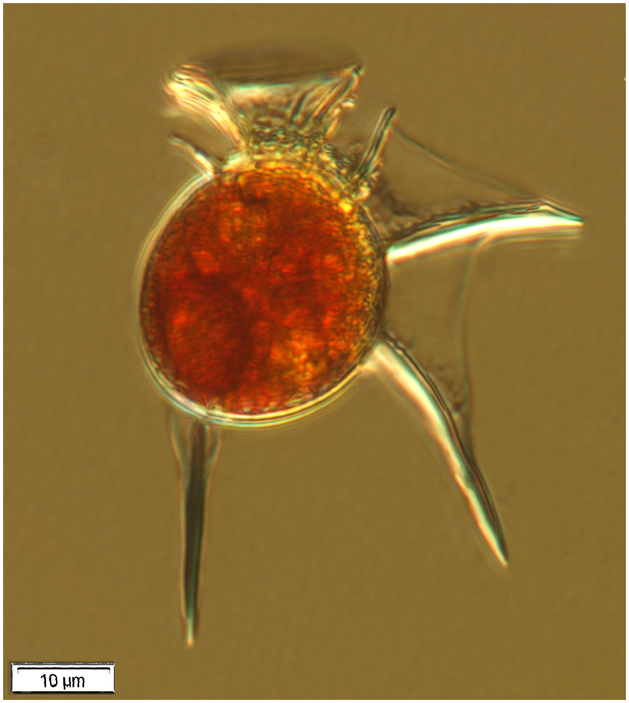 The dinoflagellate Dinophysis scheuttii (Murray & Whitting 1899)