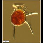 The dinoflagellate Dinophysis scheuttii (Murray & Whitting 1899)