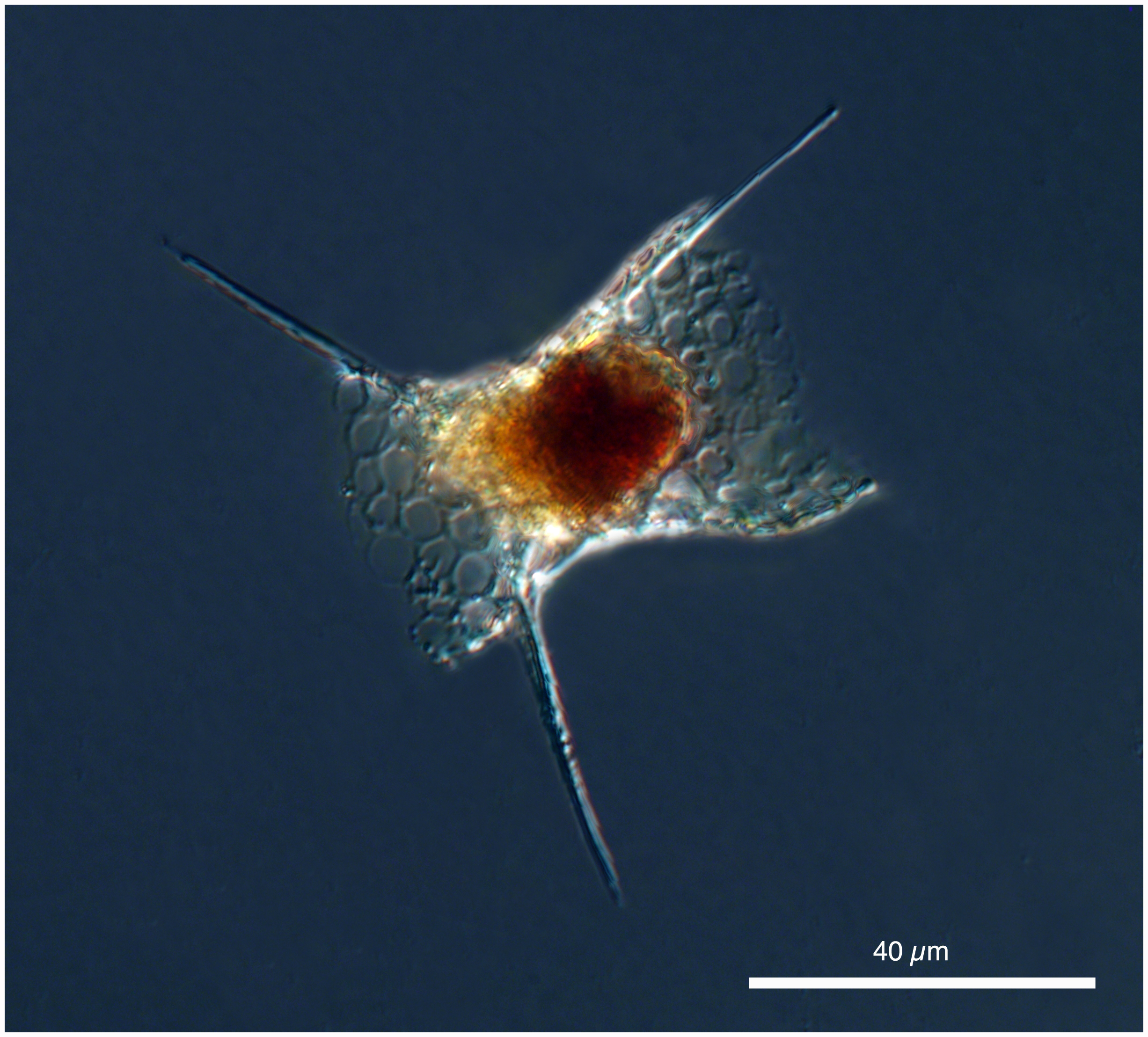 radiolarian Permomelissa or Dimelissa thoracites (Haeckel). [Lophophaenidae] Formerly known as Lithomelissa thoracites