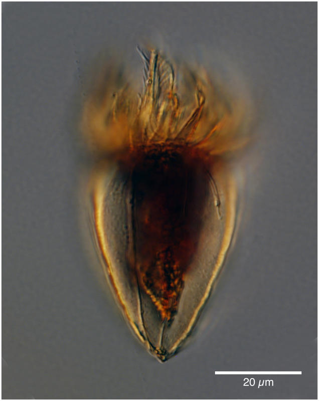 Protorhabdonella simplex