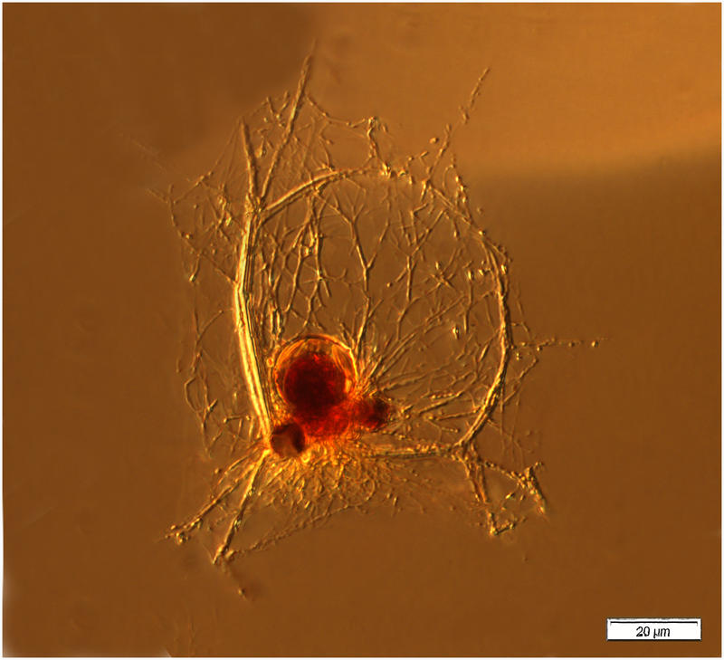 a radiolarian Zygocircus sp.