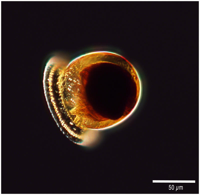 Cyttarocylis ampulla (formerly Petalotricha ampulla)