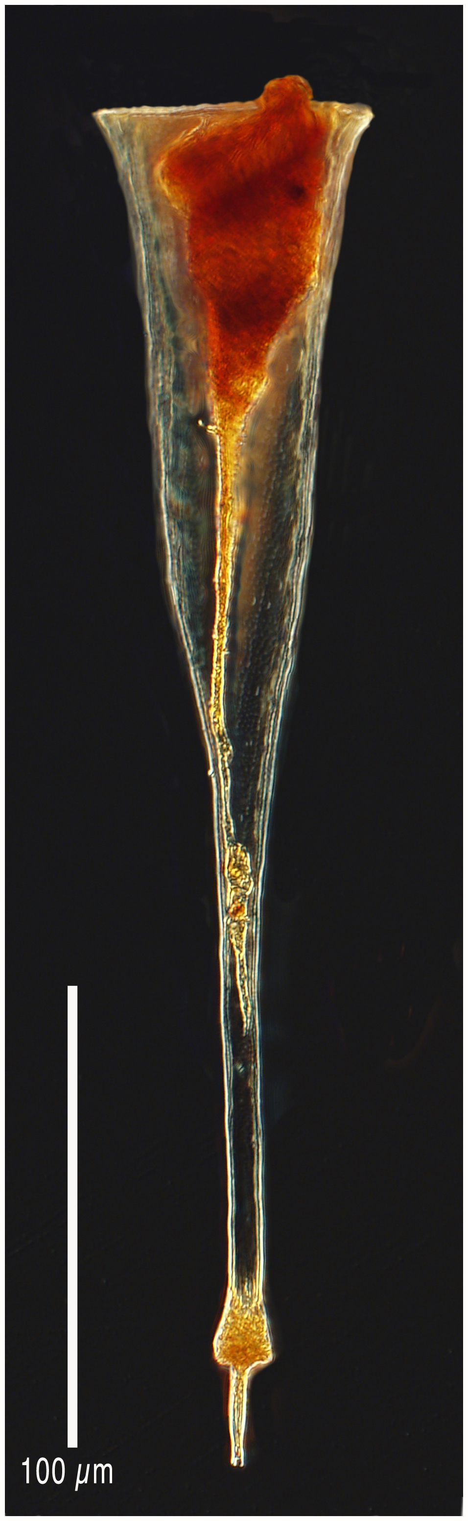 Rhabdonellopsis apophysata