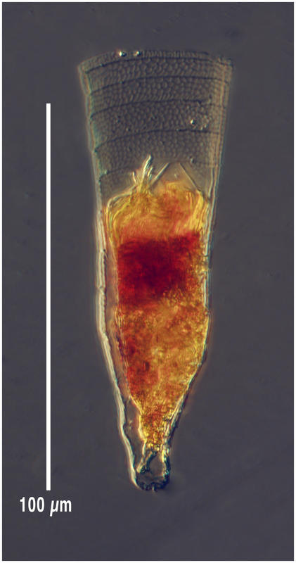 coxiella form of Xystonella lanceolata