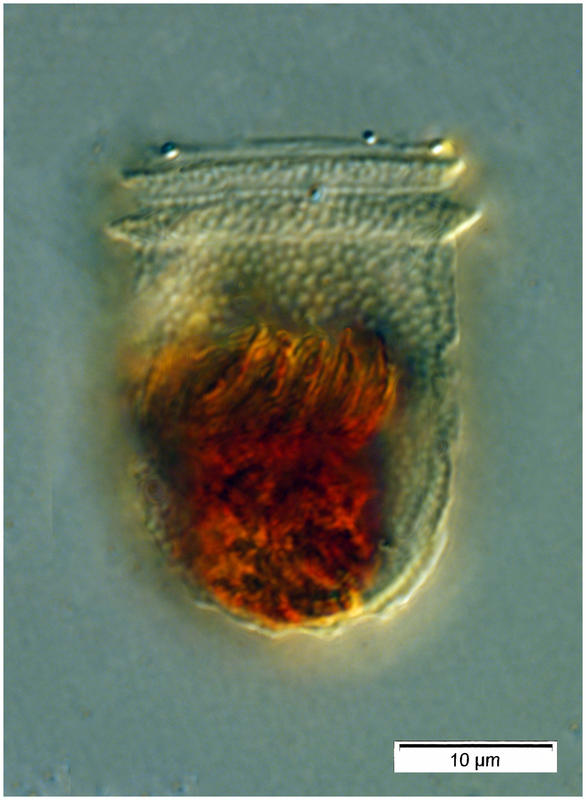coxiella form of Ascampbelliella armilla