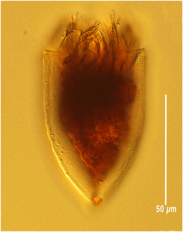 Favella sp. azorica?