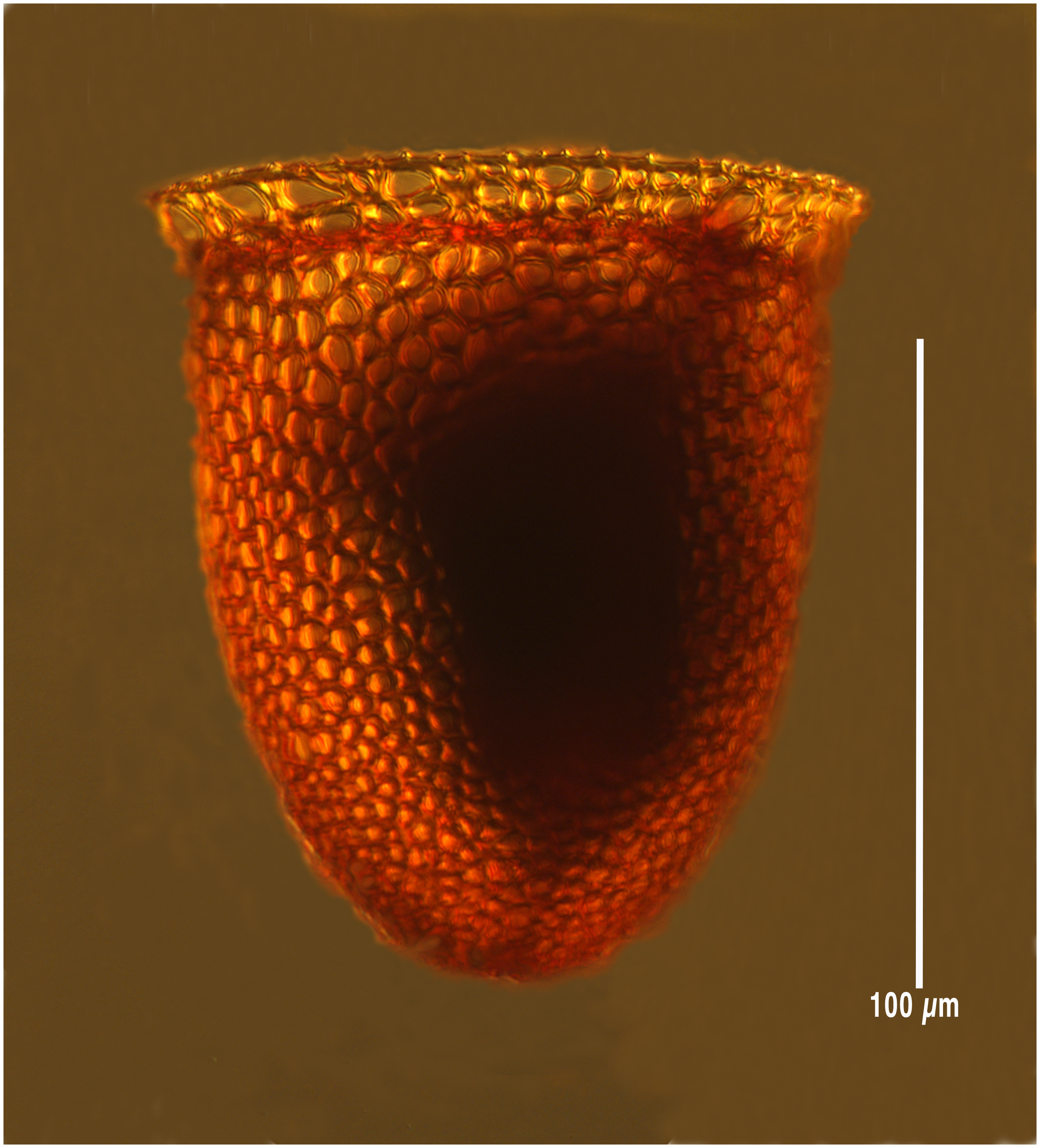 Cyttarocylis ampulla (forma eucrycephalus)