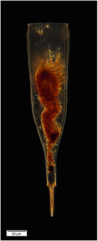 Xystonellopsis favata from the South Pacific (Outpace St B, CTD 110, bottle1)