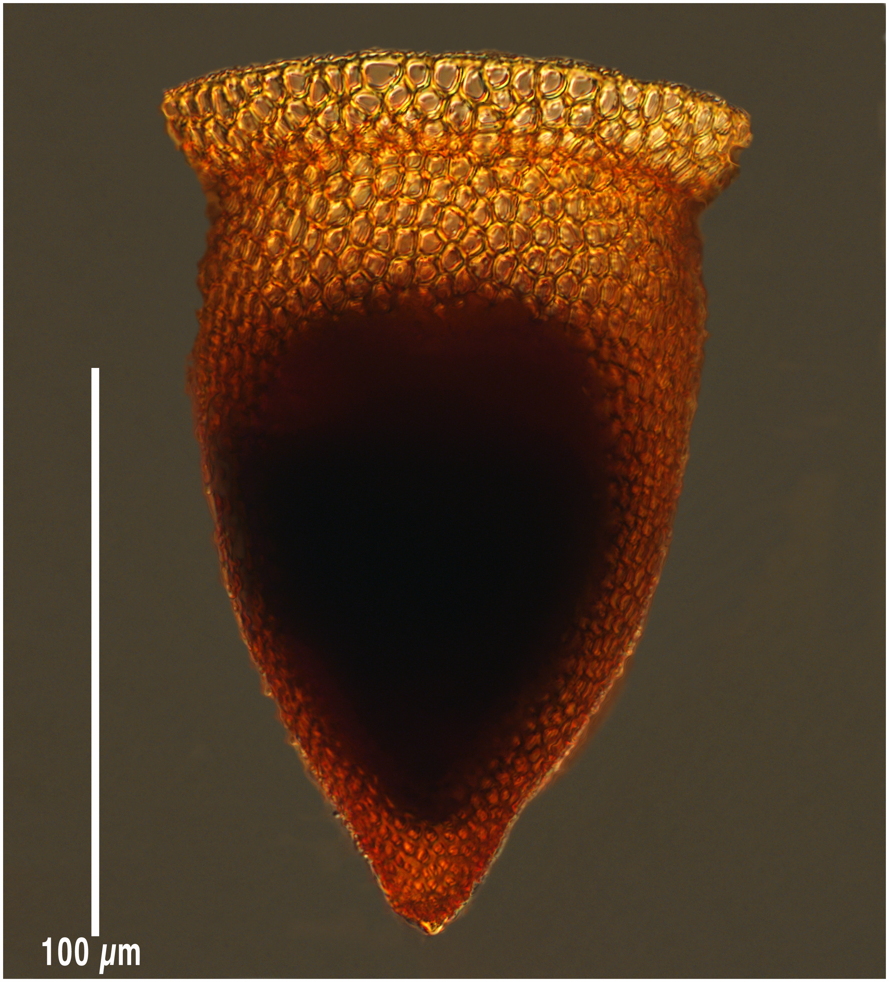 Cyttarocylis ampulla (cassis form)