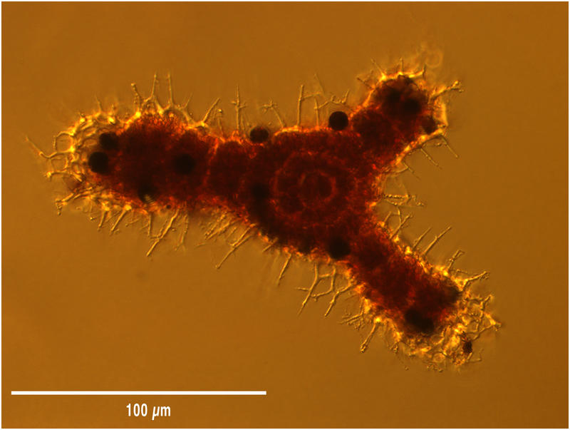 Dictyocoryne sp (Spumellarian radiolarian)