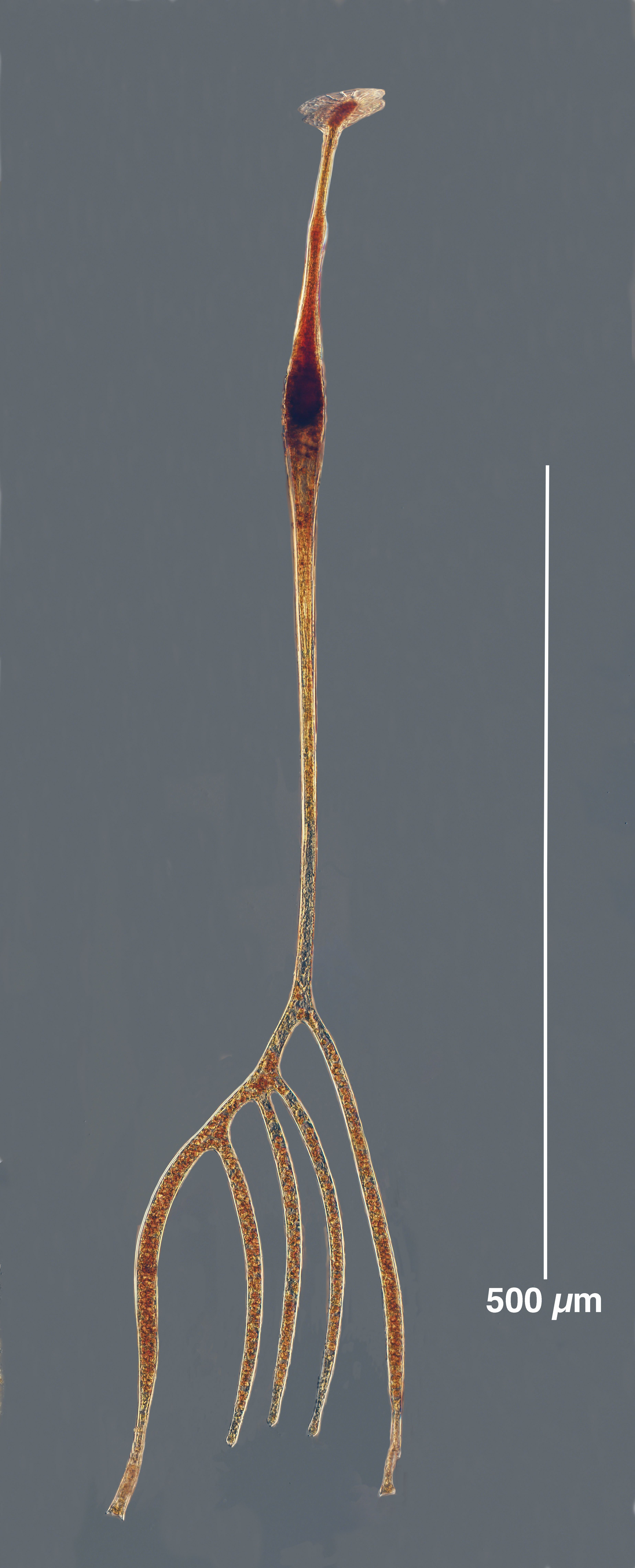 Amphisolenia quinquecauda (Kofoid 1910)