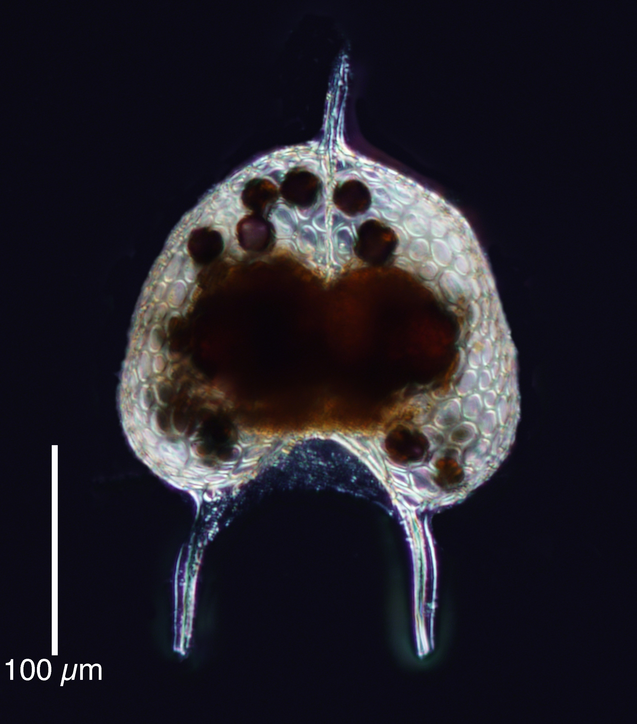 Tholospyris sp. from the Bay of Villefranche in September 2015