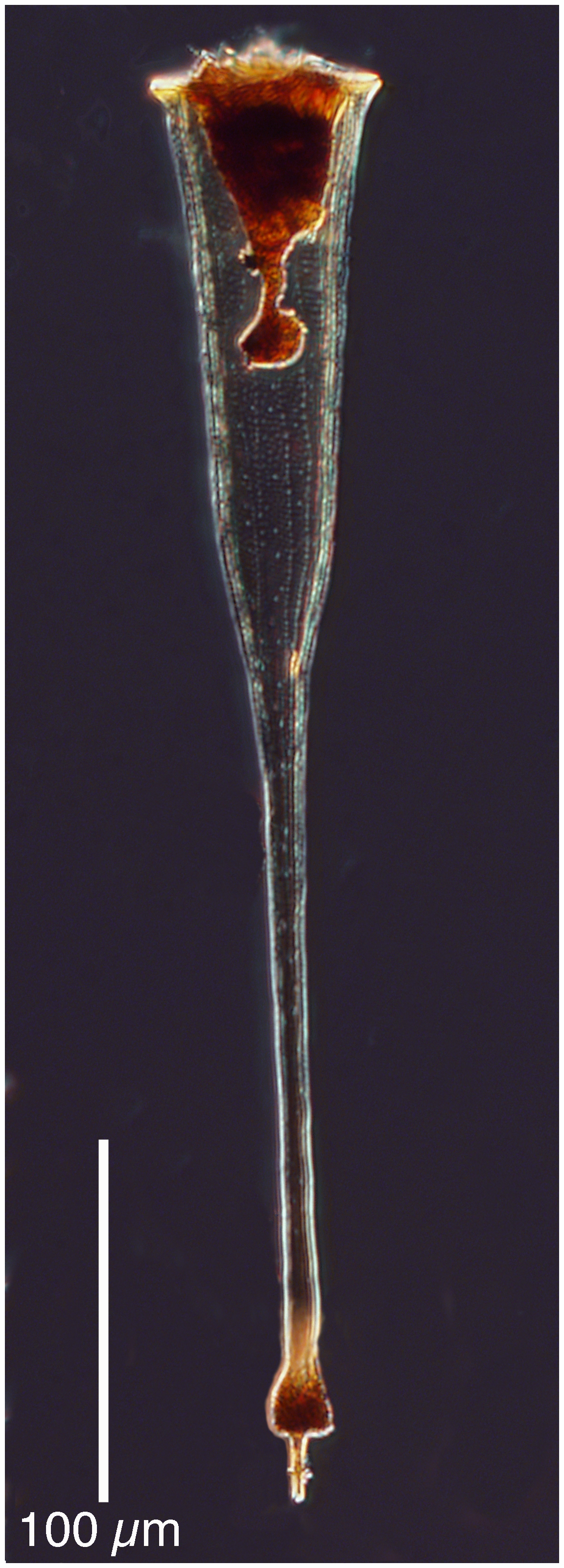 Rhabdonellopsis triton