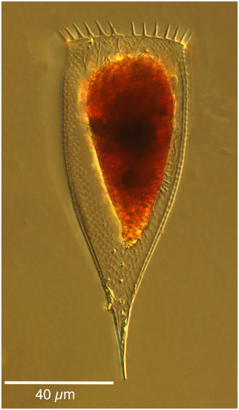 Parafavella parumdentata 'obtusangula' morph