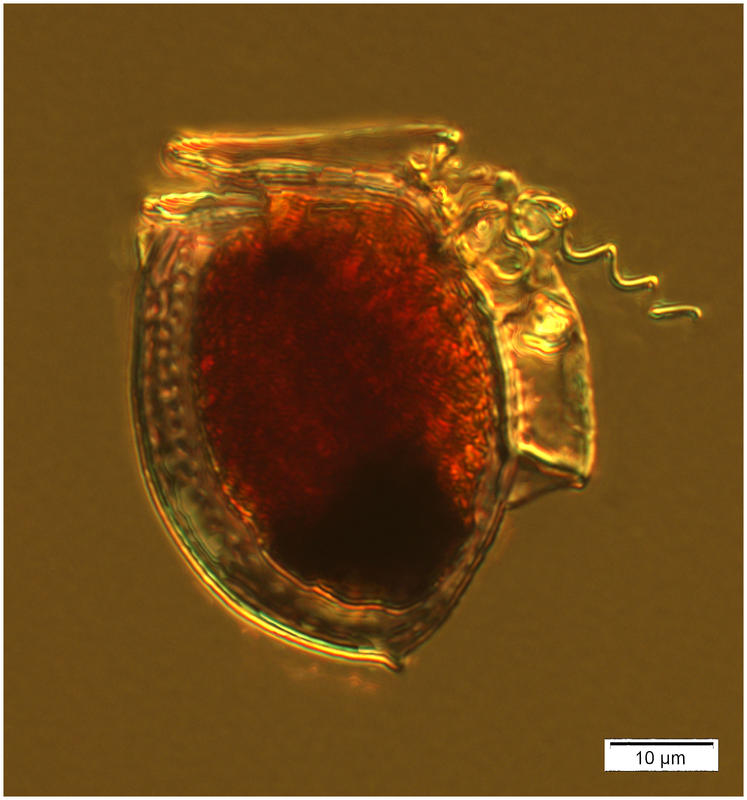 64xdinophysisexpd4arctic2015