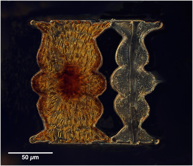 Biddulphia tuomeyi (benthic diatom usually)