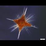 Deep Water Acantharian