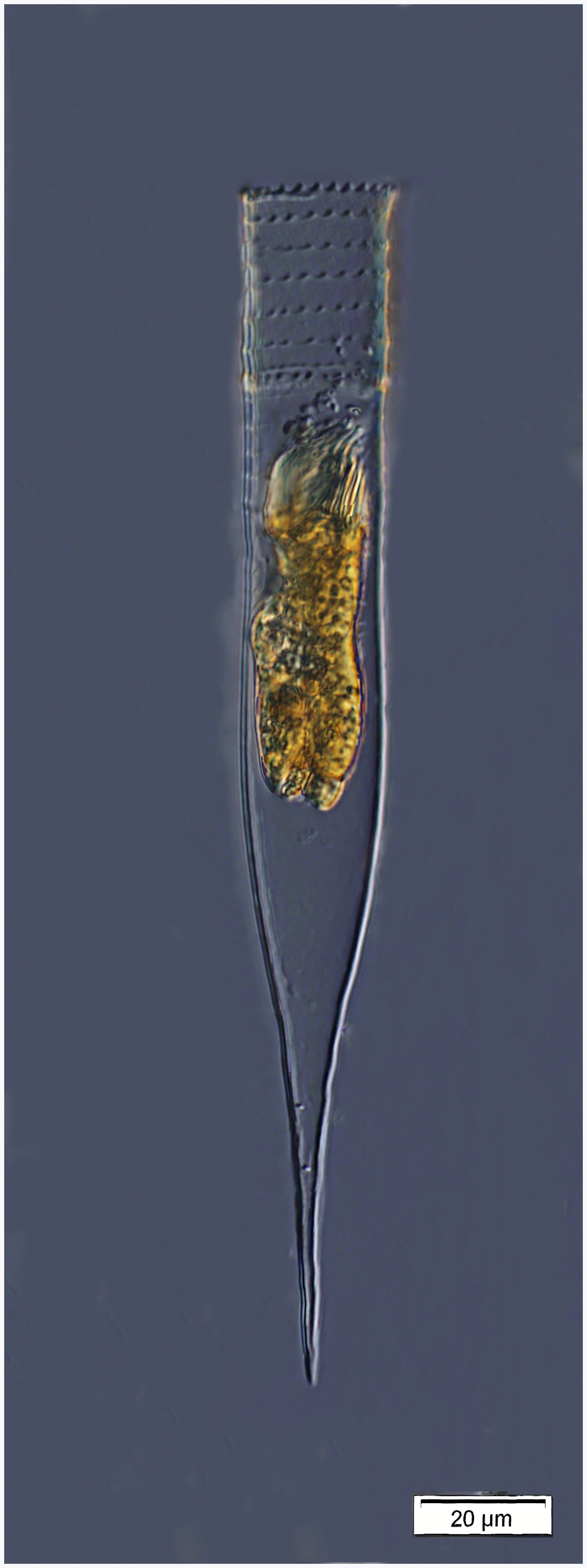 Helicostomella subulata