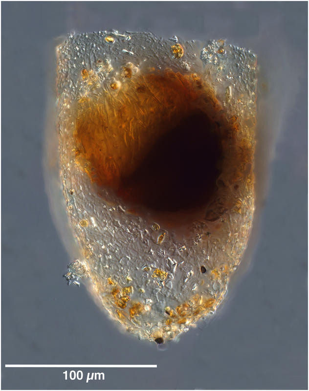 Bursaopsis vitrea