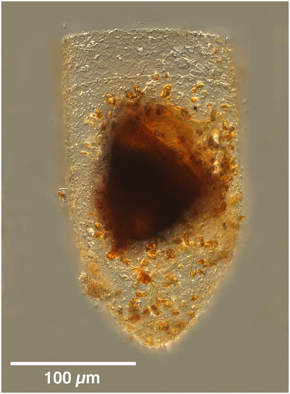 Bursaopsis vitrea