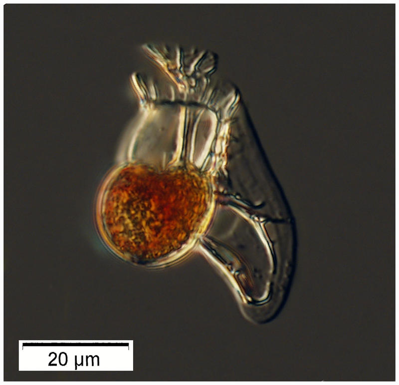 Histionteis sp. from near surface of the Tropical Atlantic