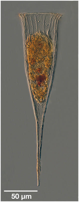 Rhabdonella spiralis from the Atlantic Ocean