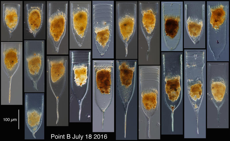 Favella enhrenbergii forms from July 18 2016