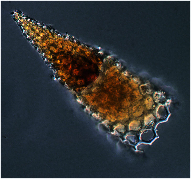 Nassularian Radiolarian - Cornutella profunda (Ehrenberg 1854)