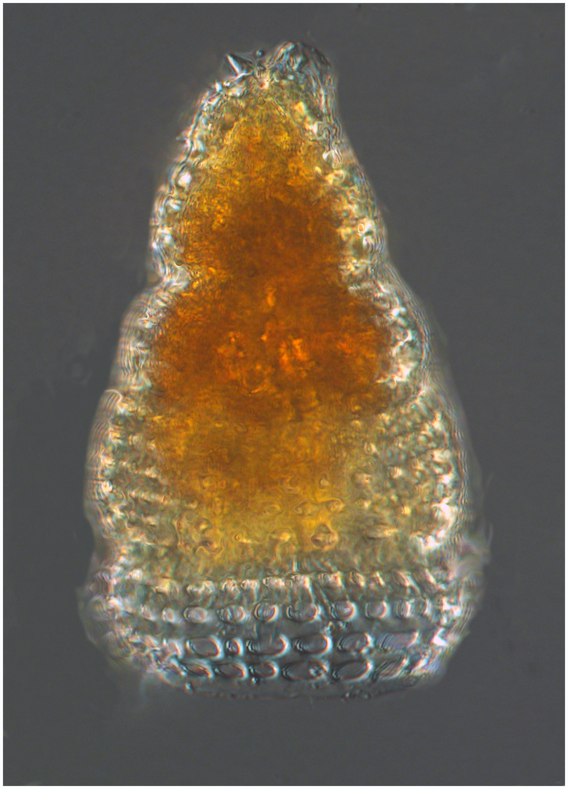 Spirocyrtis cornutella (Haeckel)