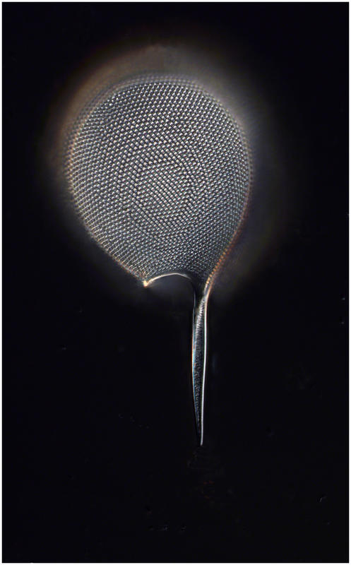 Protocystis xiphodon or Challengeria xiphodon