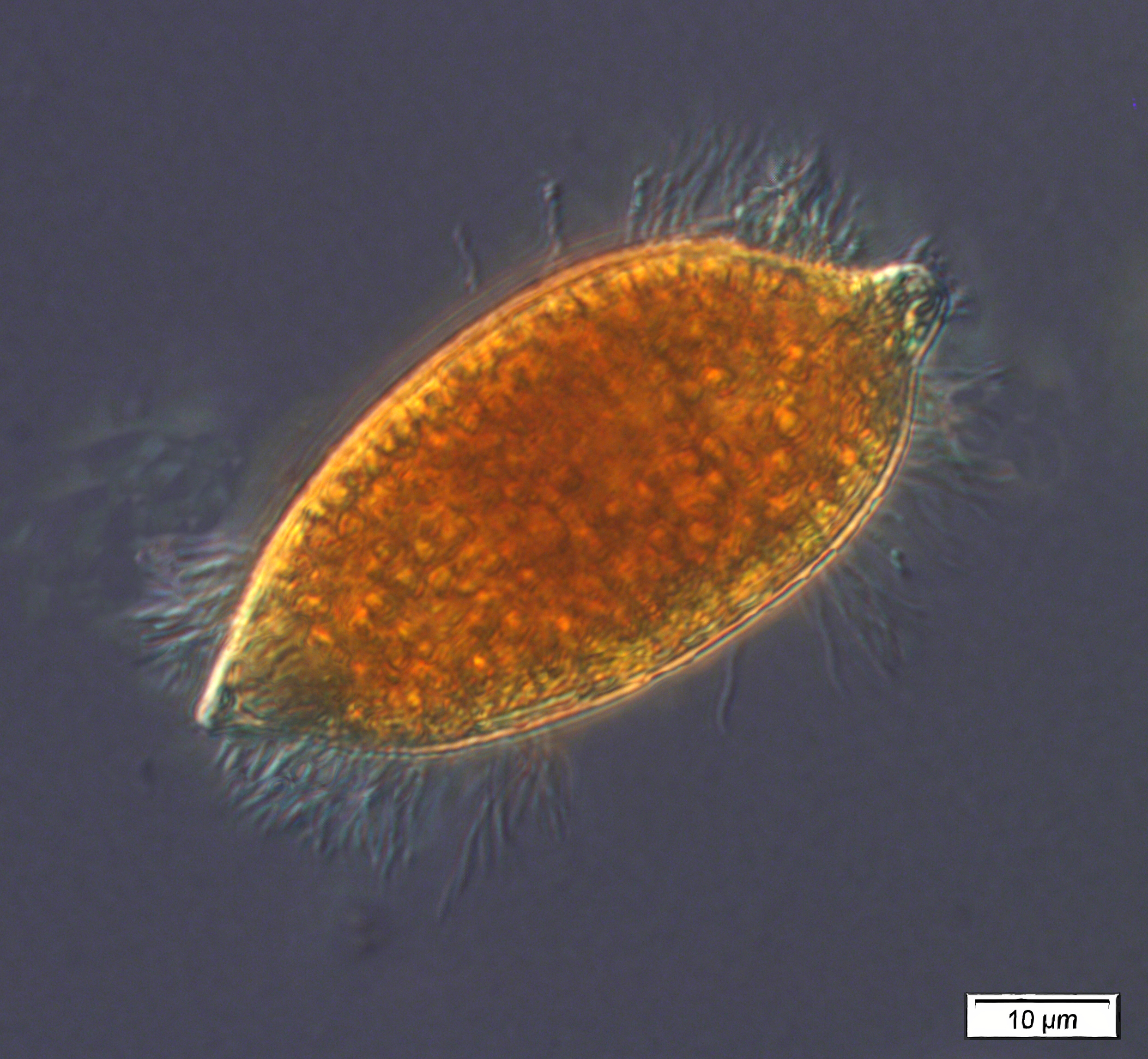 A lacrymarid ciliate